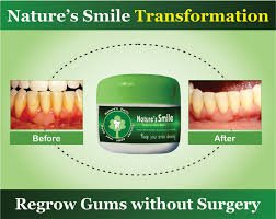 Natures Smile Results